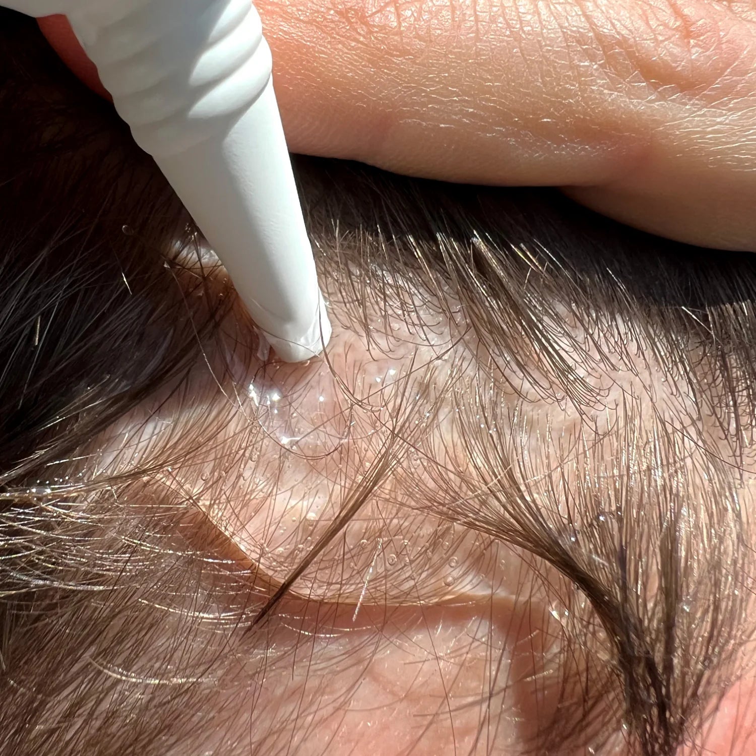 Hair Growth Kit | Trimo™