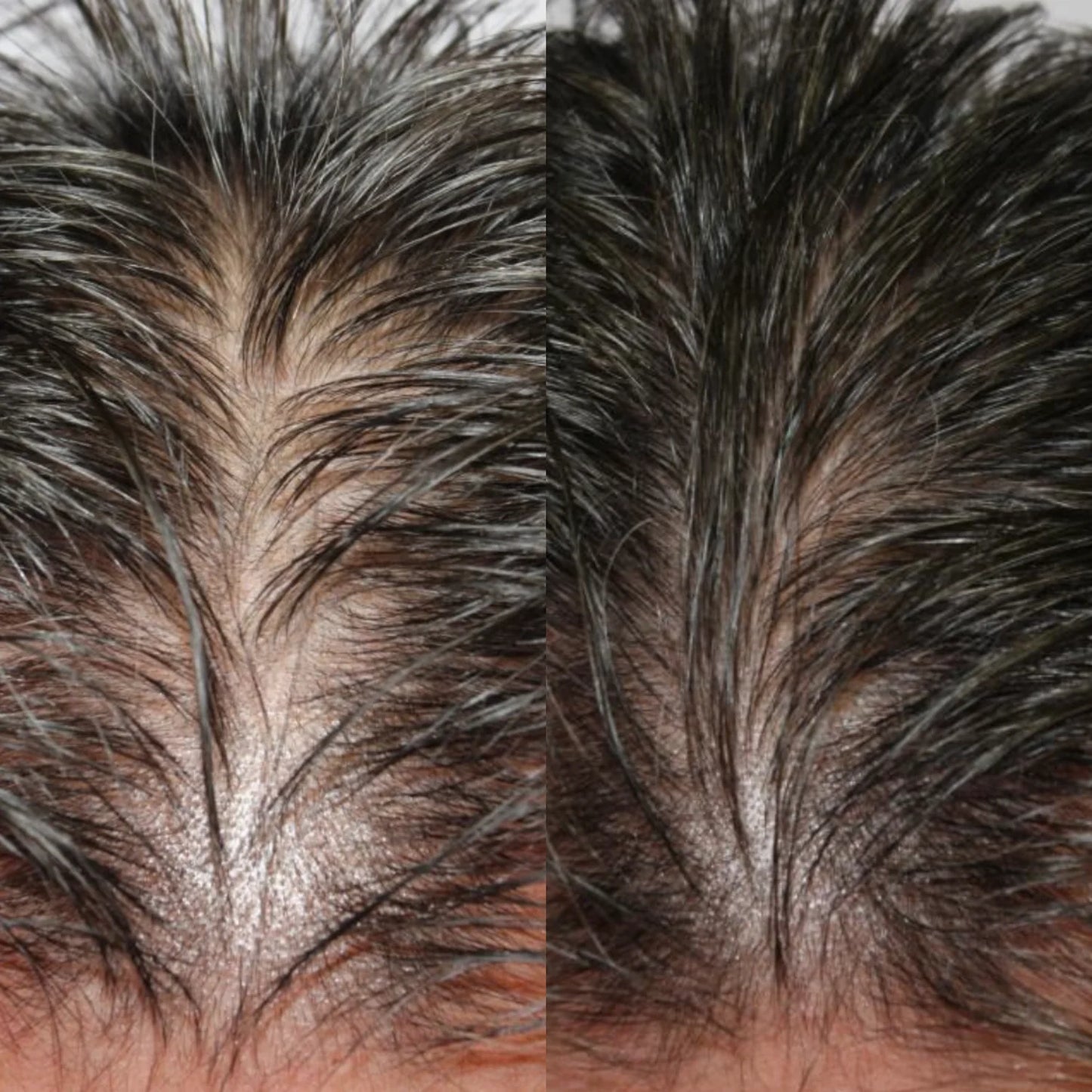 Activator de creștere a părului | Trimo™ 