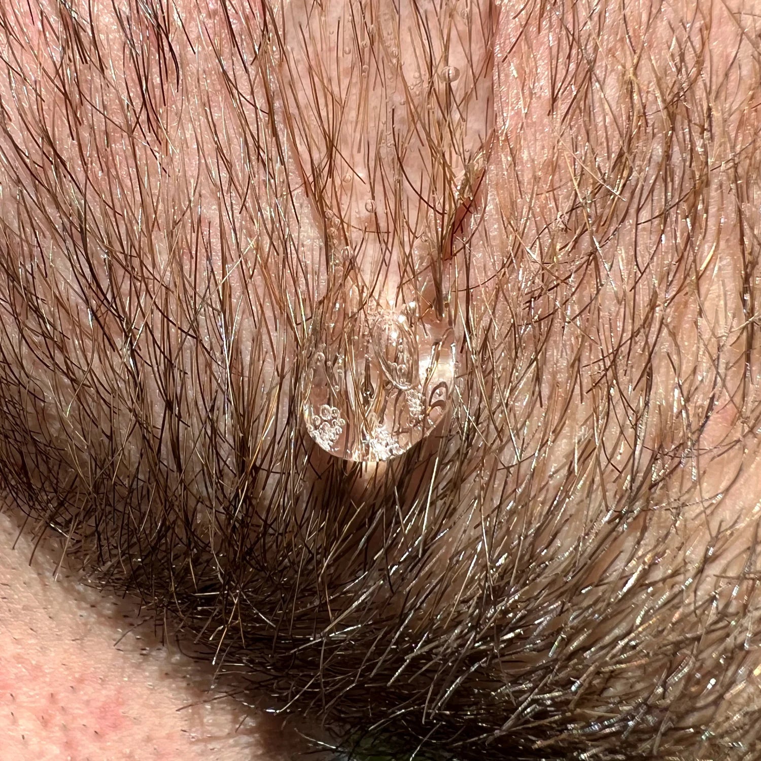 Beard Growth Stimulator | Trimo™